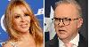 Australian prime minister Anthony Albanese apologises for ‘sexist’ comments about Kylie Minogue