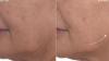 Beauty fans race to Debenhams for £40 set that stars full size £98 anti-ageing cream