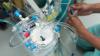 Perfusionists suspend industrial action after agreement