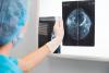 Florida woman was told nothing showed up on her mammogram. Now, she is getting $7M after her stage 4 breast cancer