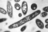 New York City Reports Cases of Legionnaires’ Disease Rise to 23