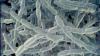 Nearly 2 dozen sickened in Legionnaires’ disease cluster in New York City