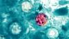 'Explosive' diarrhea parasite hits 18 states as health officials scramble to find source