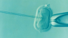 Frozen Embryo Transfer Overtakes Fresh IVF in Europe; Record Volume Hides Cost Gap