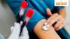 Reliance's Strand Life Sciences secures Indian patent for blood-based early cancer detection
