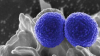 <![CDATA[SNAP Global Trial Supports Cefazolin for MSSA Bacteremia]]>