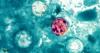 CDC reports close to 150 cases of cyclosporiasis in U.S., 46 in Florida; causes multiple intestinal issues