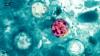 Georgia doctors warn of cyclospora cases after hundreds sickened nationwide, 86 hospitalized