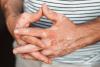 Teva draws up mid-stage study plans for vitiligo asset on Phase Ib success