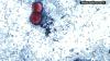 Cyclospora on the rise in New York: What to know about parasite causing severe stomach sickness