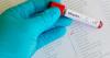 South Dakota Confirms 11th Measles Case Of 2026