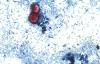 Indiana health officials keeping tabs on uptick in foodborne illness cyclosporiasis