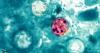 Cyclosporiasis in Maryland: MedStar Health reports latest case as summer infections rise