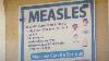 Fillmore County measles case prompts free and low-cost vaccine clinic