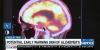 Texas A&M research finds earlier Alzheimer’s warning sign