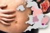 Third measles death reported as cases surge 16% in a month – map reveals outbreak ripping across England