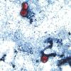 Michigan reports largest parasitic infection outbreak in state history