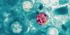 Ohio Department of Health warning spread of ‘explosive’ diarrhea illness