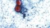 Texas reports 48 cases of 'explosive' diarrhea illness