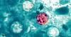 Cyclosporiasis map: 29 states now investigating diarrheal illness, including New York, New Jersey