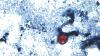 Nearly 400 cases of diarrhea-causing cyclosporiasis parasitic infection found in NY