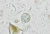 Cyclospora Cases Are Rising Across the US—Why Health Officials Are Struggling to Trace the Source