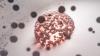 Iran launches new stem cell therapy for osteoarthritis