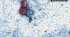 More than 50 cases of diarrhea-causing parasite confirmed in Kentucky, state health officials say