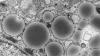 Unexplained Weight Gain in a 48-Year-Old HIV-Positive Man