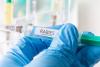 Health officials warn of potential rabies exposure in Loudoun County, elsewhere