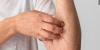 Metro health officials confirm Nashville’s first case of measles this year