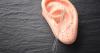Migraine pain drops after targeted ear acupuncture