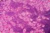 Researchers Develop a Safer, More Reliable Material for Growing Small-Scale Models of the Human Gut