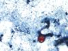 Yes, the “explosive diarrhea” parasite is in Colorado. No, it’s not a big deal.