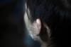 Ear Acupuncture Cuts Chronic Migraine Pain, but So Does a Sham: What Brain Scans Reveal