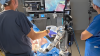 Humanoid Robots Perform First Live Surgery: Pentagon Flags the Hardware as Chinese Military Tech