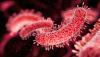 Legionnaires' outbreak hits New York's Upper East Side: Here's what you need to know