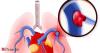 Healthy young man spends whole day watching movies. Gets up to stretch a drops dead. Doctor explains the one habit that killed him: 'Never sit....'