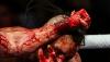 New Mexico might ban bare-knuckle fighting