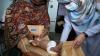 3.7 Million Afghan Children Under Five Face Heightened Risk of Malnutrition, UNICEF Warns