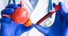 2nd PET scan changes treatment for nearly half of prostate cancer patients