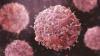 FG Expands Cancer Support Funds, Boosts Local Research, Drug Production