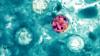 CDC tracking cyclospora cases in 31 states, including Nebraska and Iowa