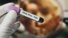 Oxford University starts 1st human trial of new Ebola vaccine