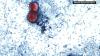 New York City sees three-fold increase in parasitic infections compared to last year