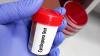 Case of diarrhea-causing parasite found in Arkansas