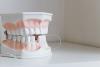 Gum Disease Bacteria Found to Harden Heart Valves via IL-1β Inflammatory Pathway