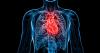 Sen. Lindsey Graham just died of aorta disease. My husband did too.