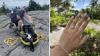 Injured on a hike, she had to be carried off the mountain. He still proposed.