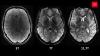 Brain Scan AI Beats GPT-5 by Over 20 Points in Real-Week Hospital Trial